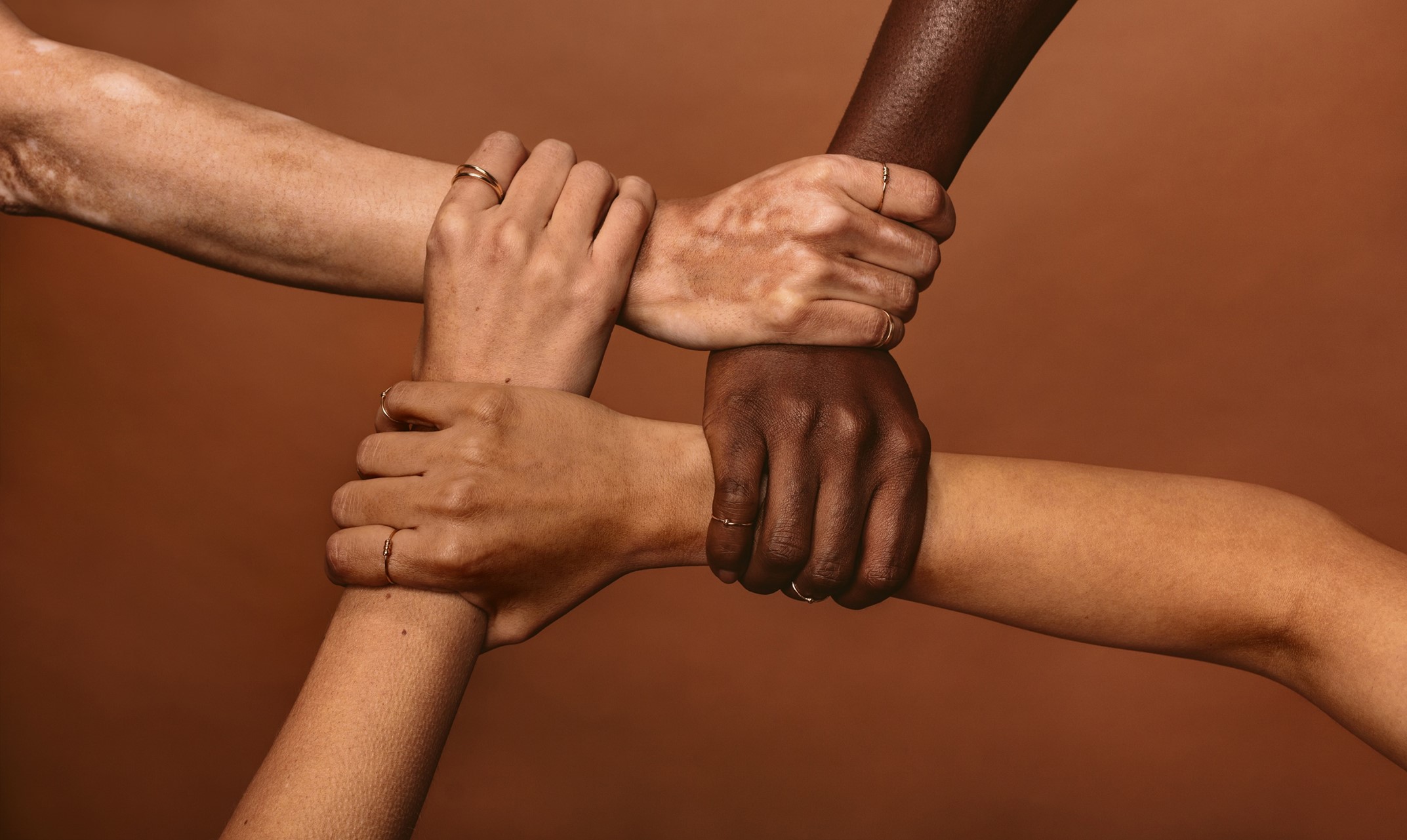 Equality, Diversity and Discrimination